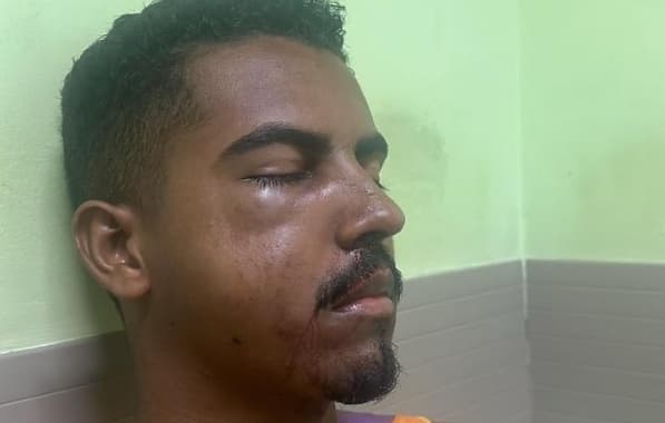 Militante do PT é agredido durante festa no Litoral Norte baiano; lideranças repudiam ataque