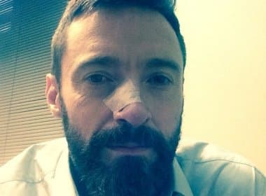 Intérprete de Wolverine, Hugh Jackman faz nova cirurgia para retirada câncer