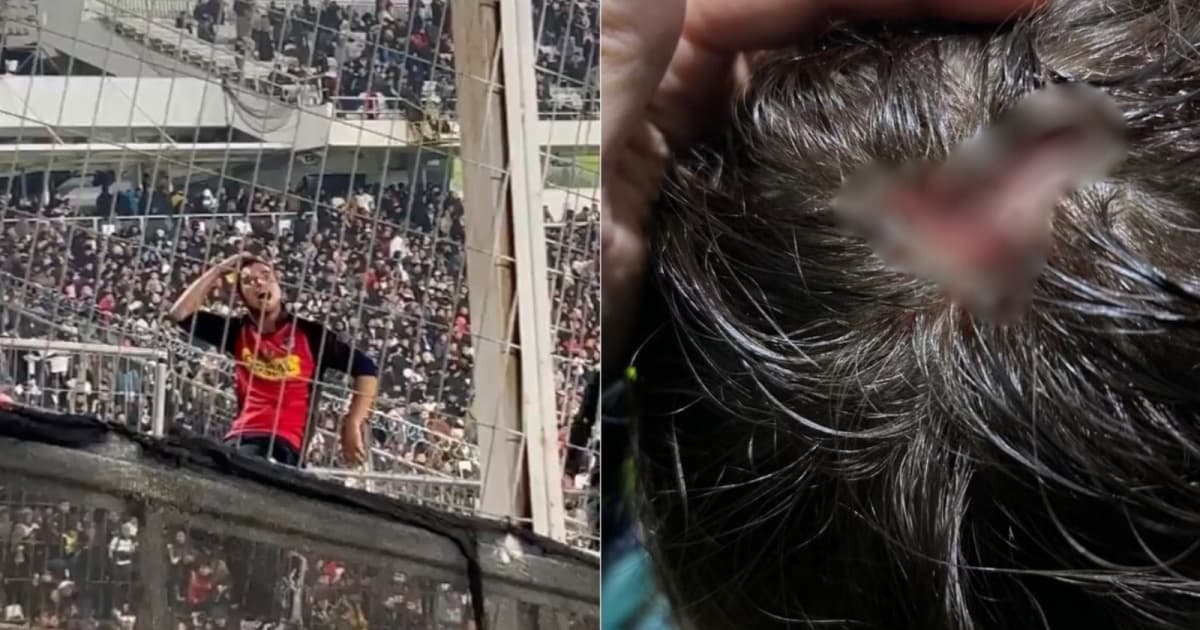 No duelo contra o Colo-Colo, torcida do Fluminense sofre com atos de violência e racismo no Monumental de Santiago