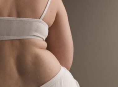 Chance de ter câncer é 40% maior em mulheres obesas