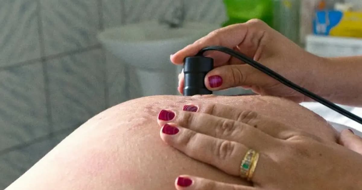 Ministério da Saúde alerta para riscos de grávidas com febre do oropouche