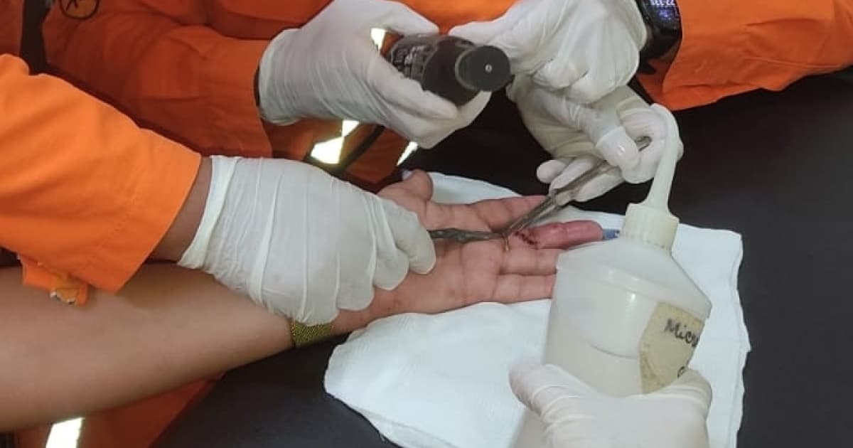 Bombeiros retiram anel de dedo de paciente