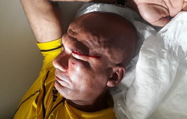 Árbitro expulsa jogador e é agredido em campeonato no interior baiano; agressor foi preso