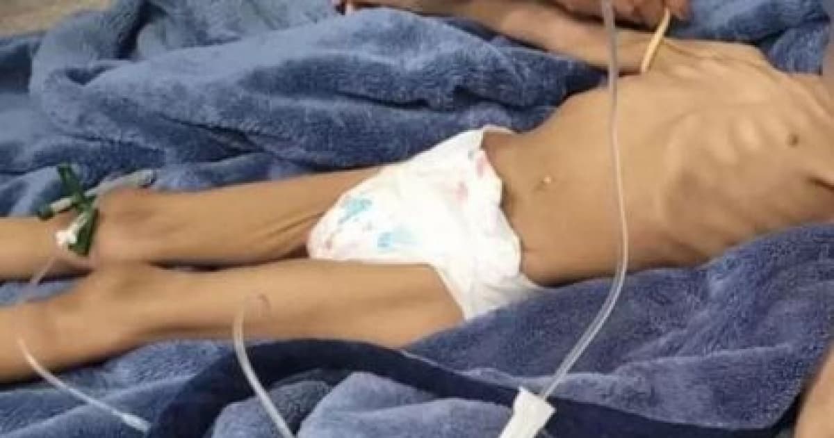 Homem é preso após ser acusado de deixar filha de 3 anos sem comer por 40 dias 