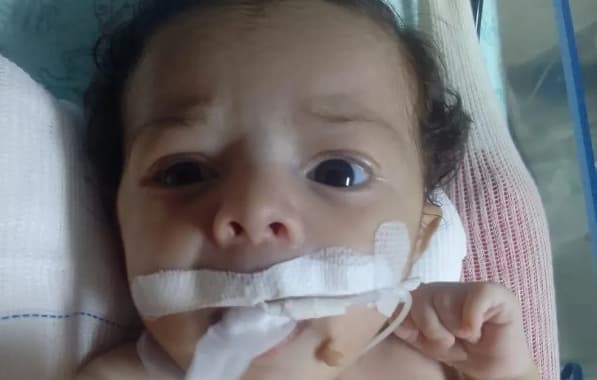 Salvador: Bebê de 2 meses morre após ter tido leite injetado no acesso ao invés de remédio