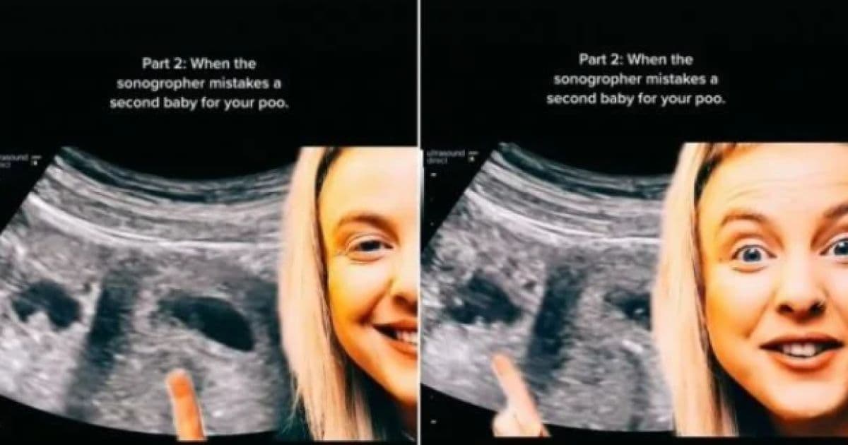 VÍDEO: Em ultrassom, médico confunde cocô de grávida com segundo bebê