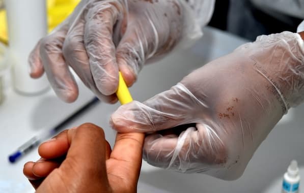 Julho Amarelo: Secretaria Municipal da Saúde promove ações de diagnóstico e tratamento às hepatites virais em Salvador