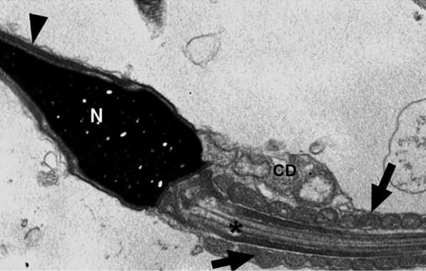 Vírus da Covid-19 pode permanecer no espermatozoide até 110 dias após contágio, diz pesquisadores 