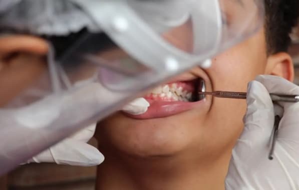 Brasil regista 45% de cobertura em saúde bucal; meta é chegar a 70%