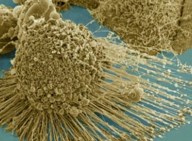 Descoberta de mutações que dão origem a câncer pode ser marco no tratamento  de tumores
