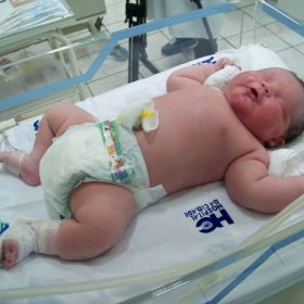Bahia Noticias Noticia Bebe Com Peso De Uma Crianca De Cinco Meses Nasce No Rs 10 02 12