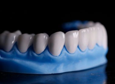 Sobreviventes da Covid-19 relatam perda de dentes depois da infecção